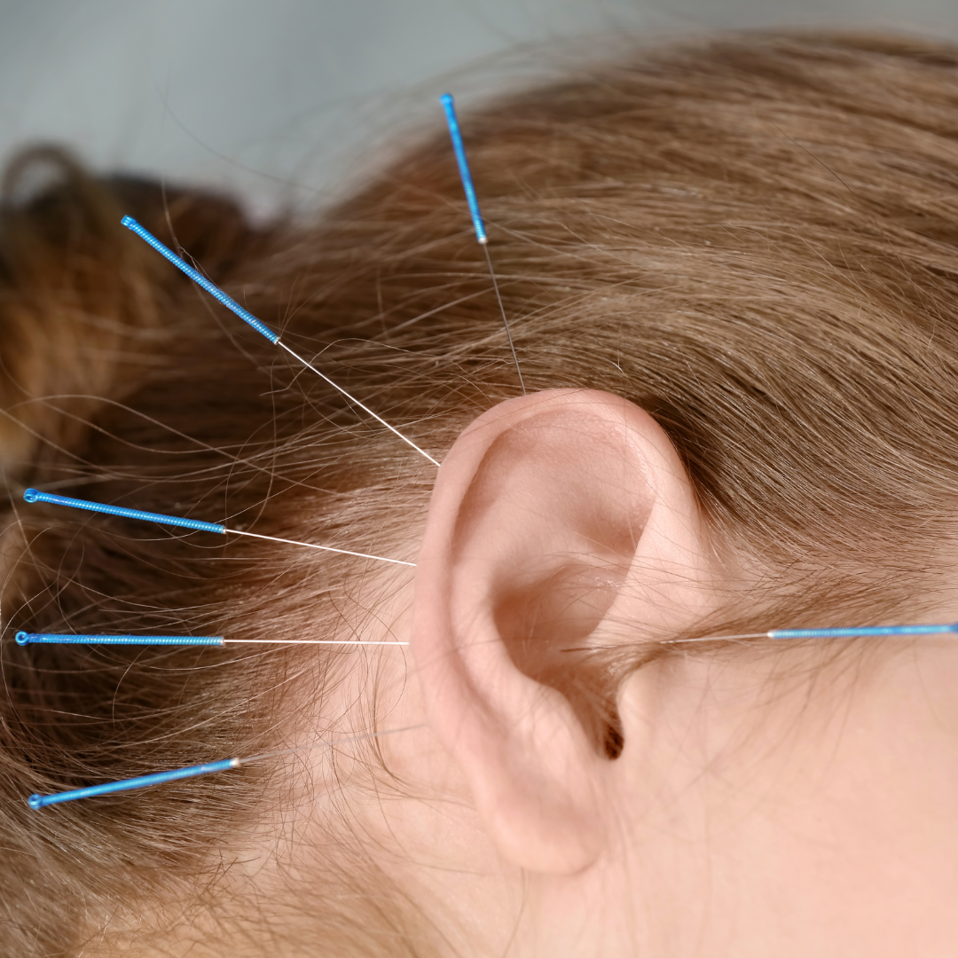 ניתוח הצמדת אוזניים - אופטימל - המרכז לרפואה אסתטית